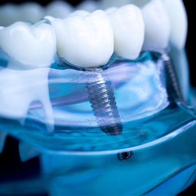 Baton Rouge Dental Office