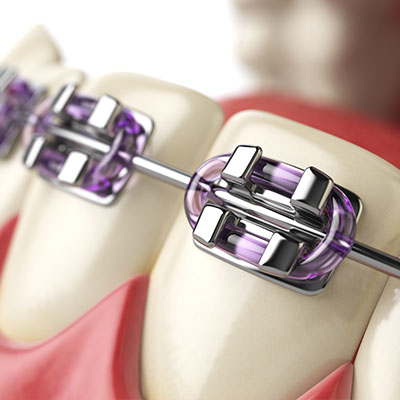 Dentist in Baton Rouge