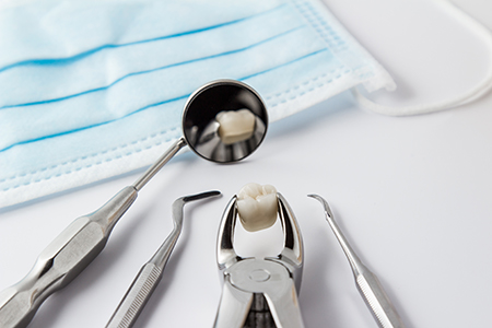 Tooth Extractions in Baton Rouge, LA | Bruns Family Dental Center